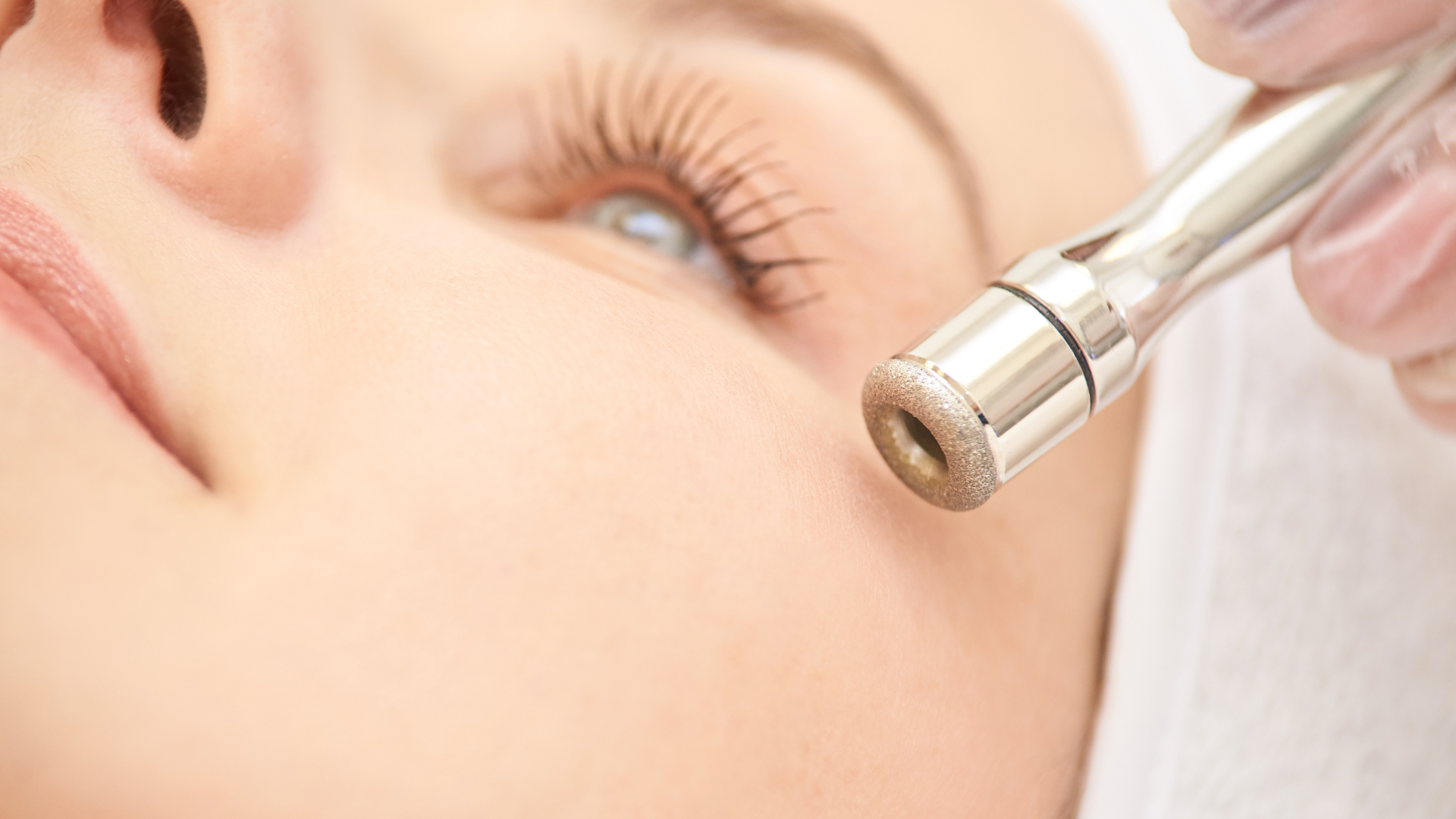 Diamond Microdermabrasion