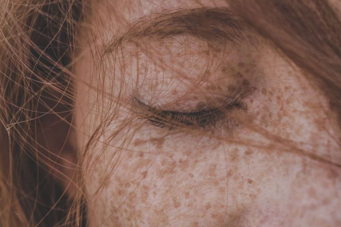 Will Red Light Therapy Help With Melasma?