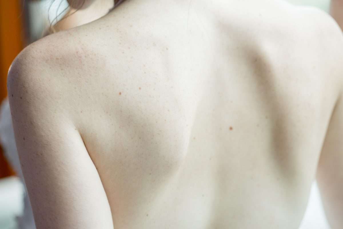 Will Red Light Therapy Tighten Skin? red light therapy loose skin